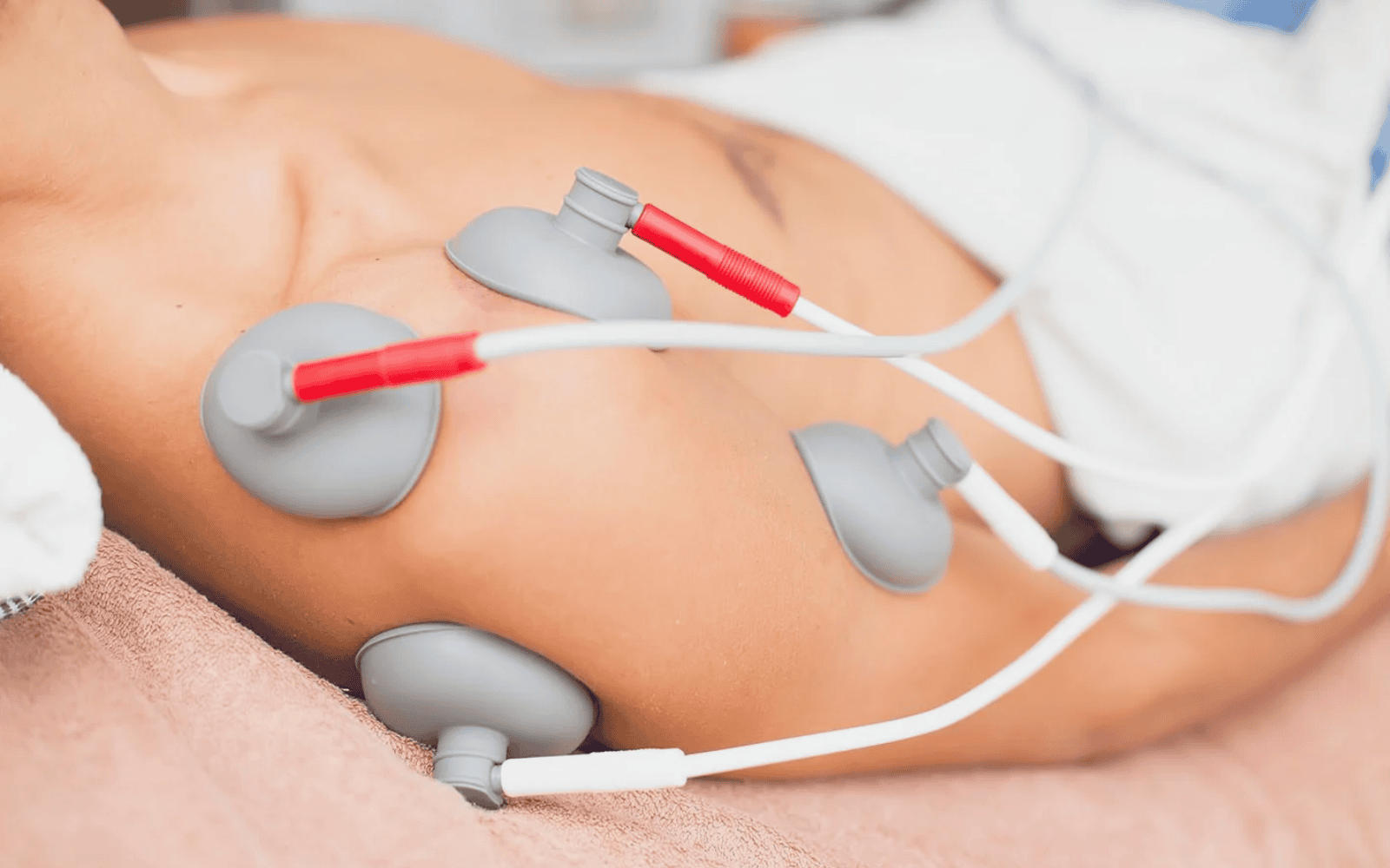 Elettroterapia con elettrodi a ventosa sulla spalla